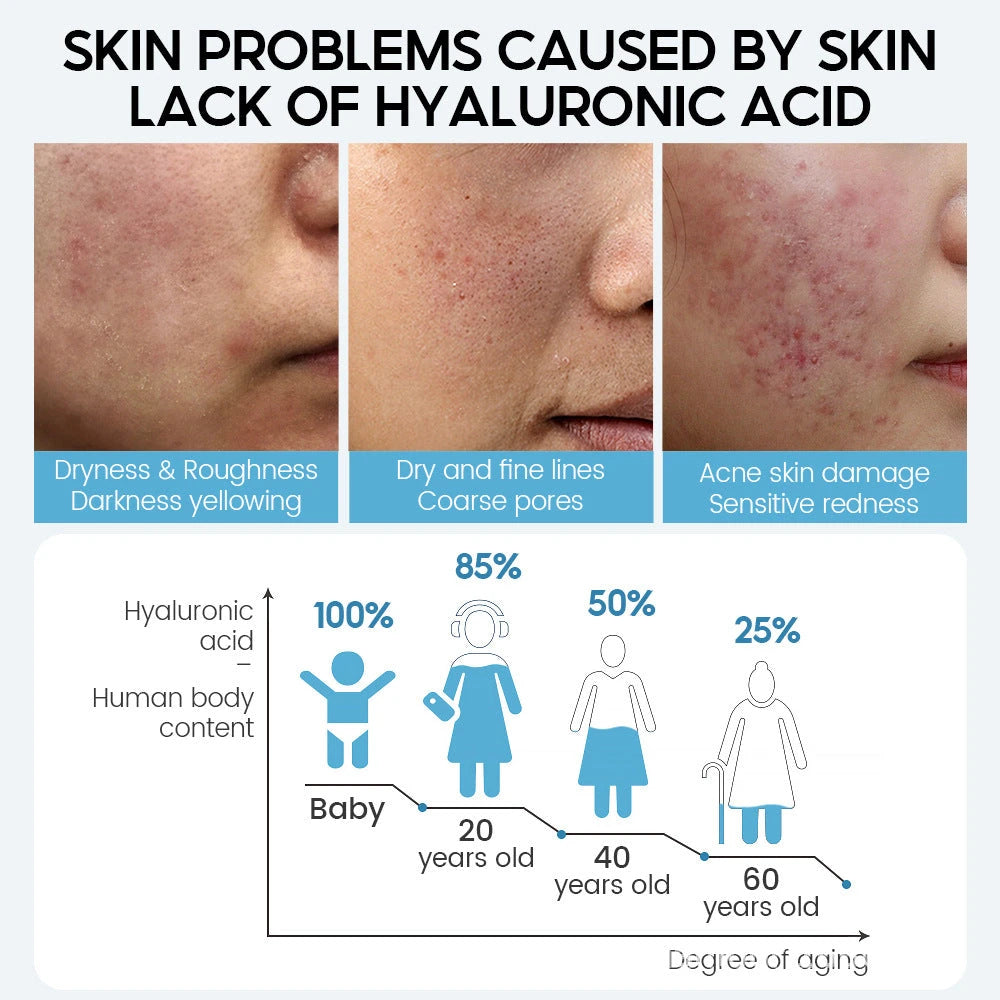 Sérum Facial con Ácido Hialurónico Antiedad – Hidratación Profunda y Poros Minimizados